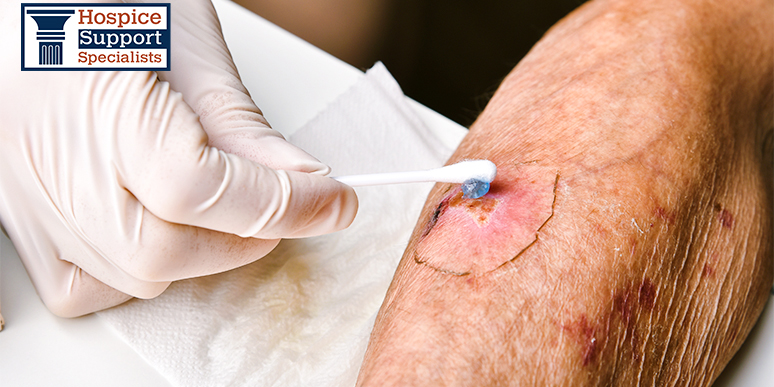 Hospice Wound Care and Vendors: The Risk of Unbundling